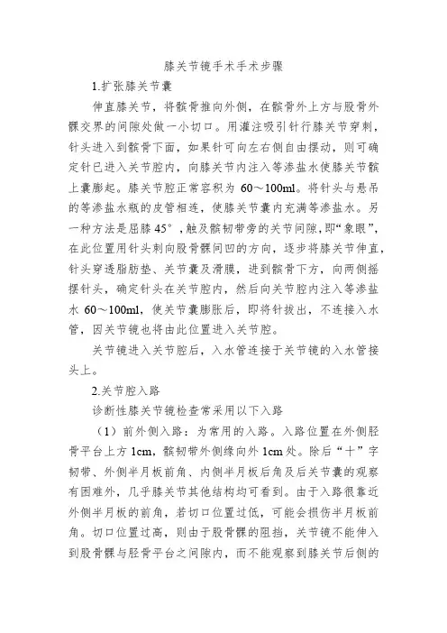 膝关节镜手术手术步骤