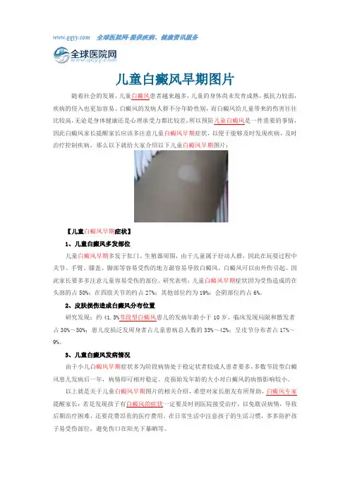 儿童白癜风早期图片