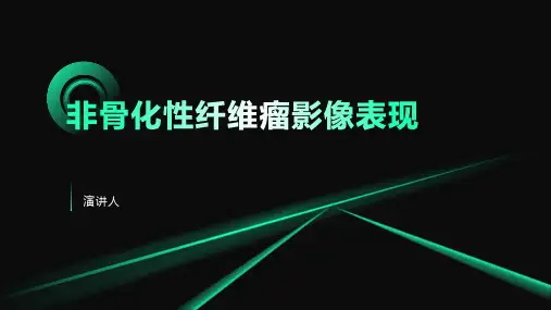 非骨化性纤维瘤影像表现