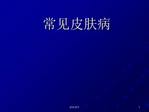 常见皮肤病诊断和治疗