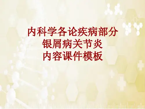 内科学_各论_疾病：银屑病关节炎_课件模板