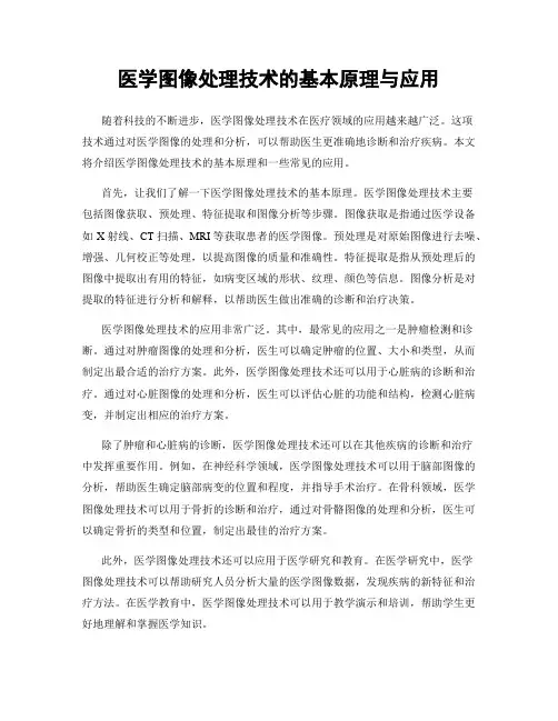 医学图像处理技术的基本原理与应用
