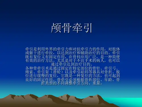 颅骨牵引PPT课件