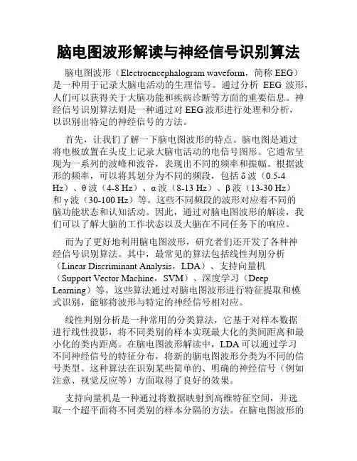 脑电图波形解读与神经信号识别算法