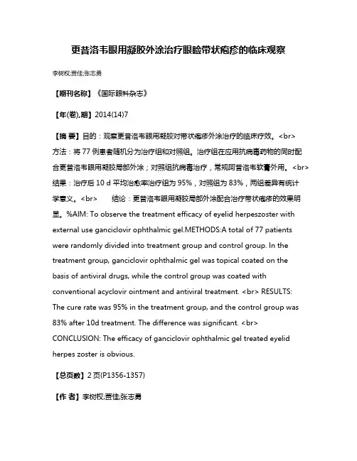 更昔洛韦眼用凝胶外涂治疗眼睑带状疱疹的临床观察
