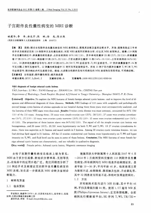 子宫附件良性囊性病变的MRI诊断