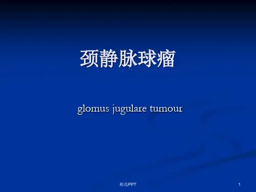 颈静脉球瘤