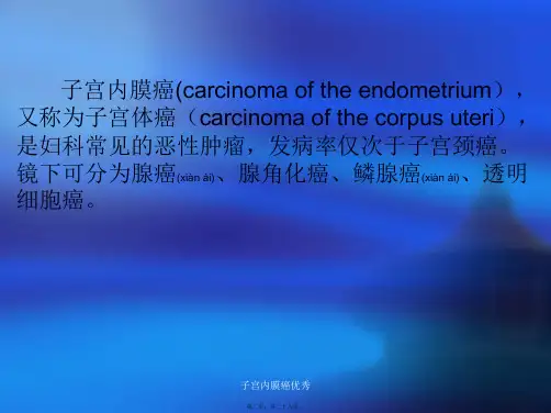 子宫内膜癌优秀课件