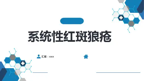 系统性红斑狼疮ppt课件可修改全文