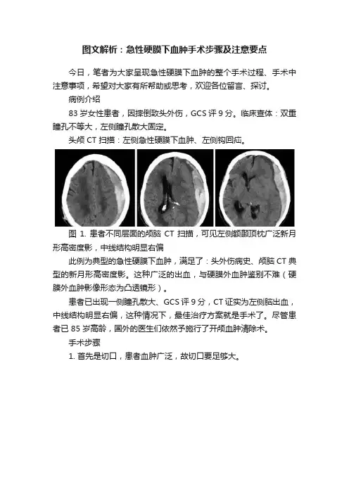图文解析：急性硬膜下血肿手术步骤及注意要点