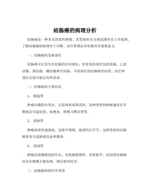 结肠癌的病理分析