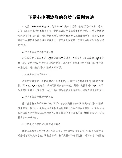 正常心电图波形的分类与识别方法