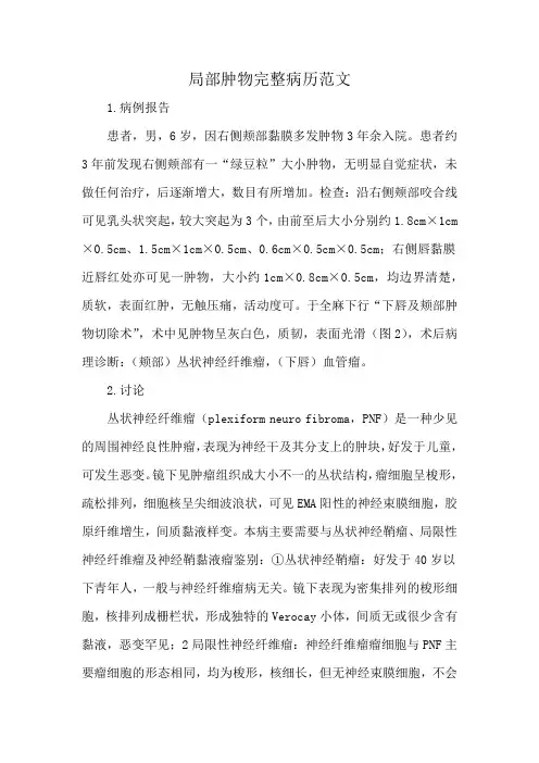 局部肿物完整病历范文