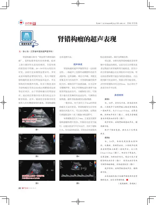 肾错构瘤的超声表现