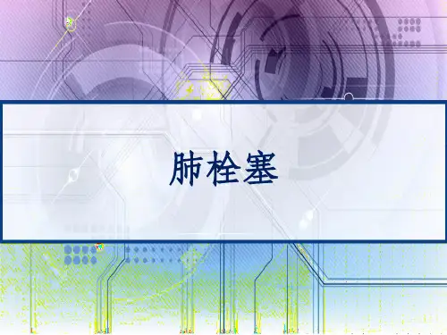 肺栓塞实用课件 PPT