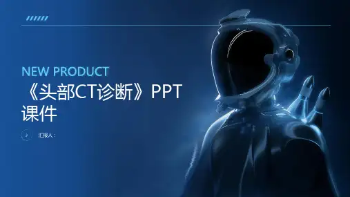 《头部CT诊断》课件
