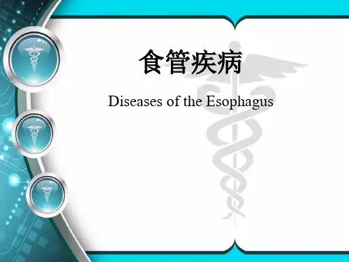 第九版外科学课件食管疾病