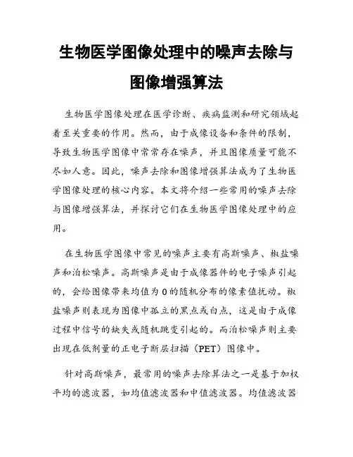 生物医学图像处理中的噪声去除与图像增强算法