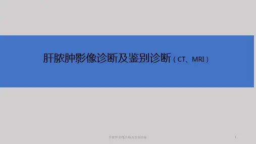 肝脓肿影像诊断及鉴别诊断课件