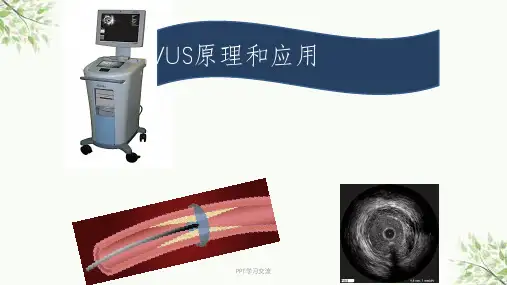 血管内超声IVUS原理和应用课件