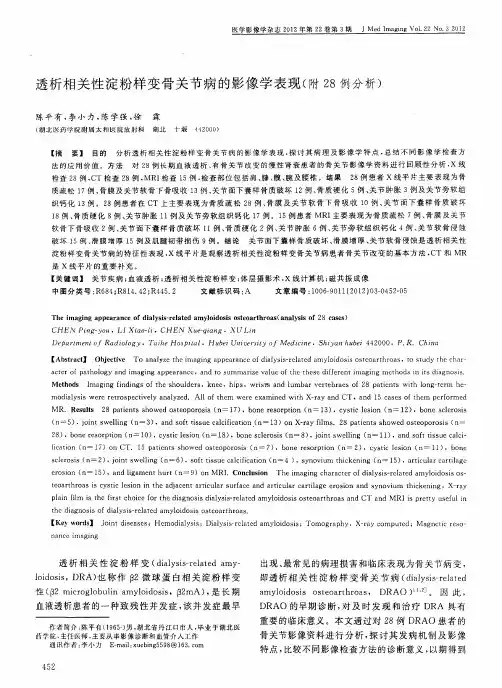 透析相关性淀粉样变骨关节病的影像学表现(附28例分析)