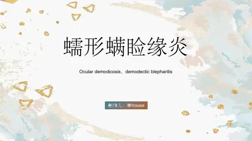 《蠕形螨睑缘炎》PPT课件