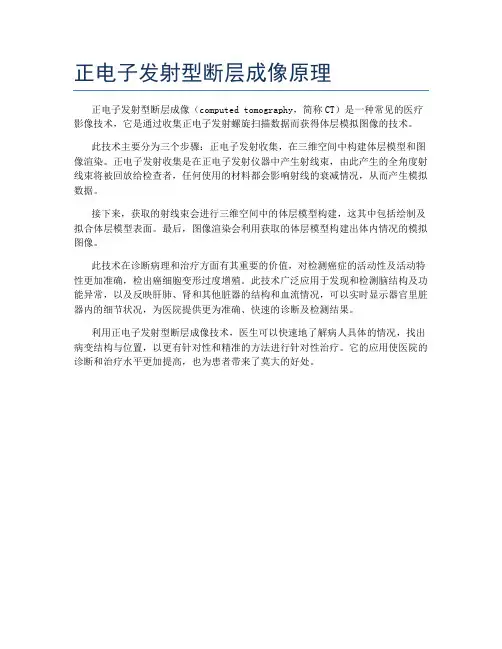 正电子发射型断层成像原理