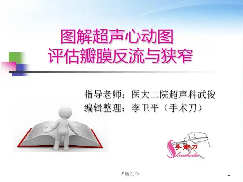 图解超声心动图评估瓣膜反流程度(清晰详实)