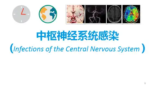 中枢神经系统感染ppt课件