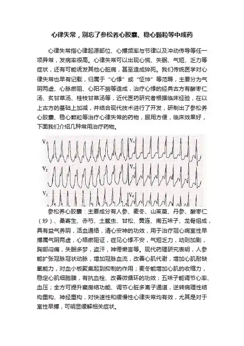 心律失常，别忘了参松养心胶囊、稳心颗粒等中成药