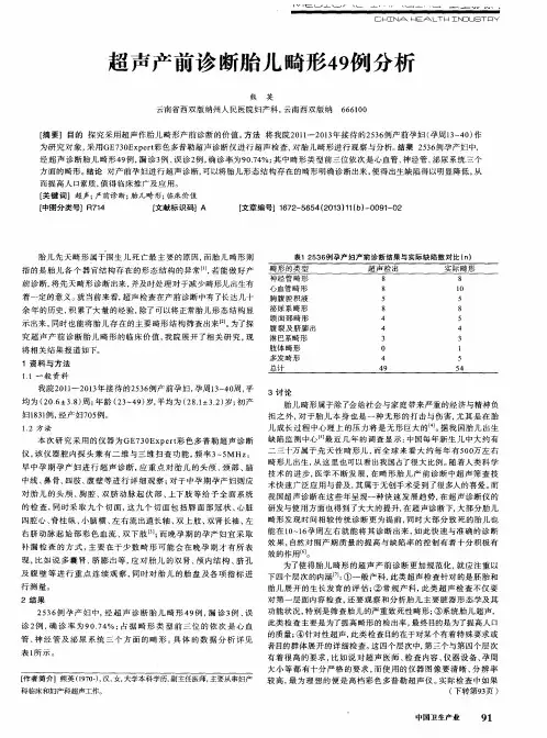 超声产前诊断胎儿畸形49例分析