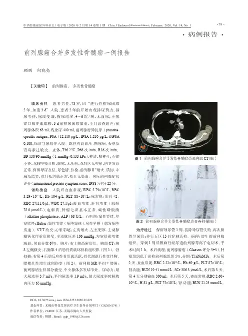 前列腺癌合并多发性骨髓瘤一例报告