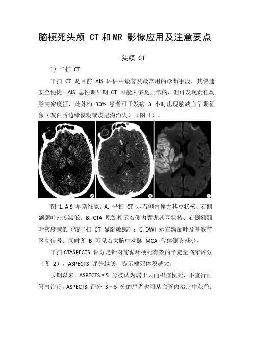 脑梗死头颅 CT和MR 影像应用及注意要点