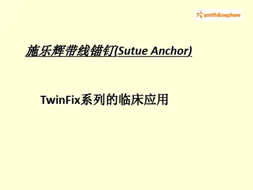 TwinFix锚钉