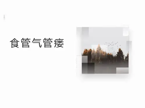 食管气管瘘