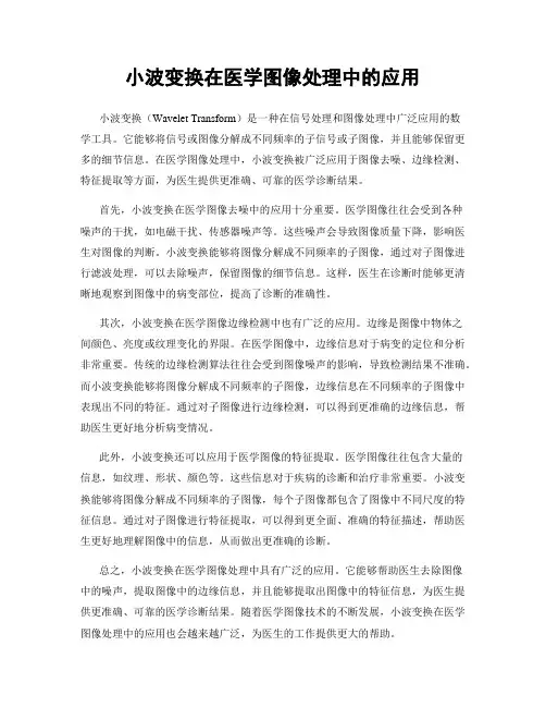 小波变换在医学图像处理中的应用