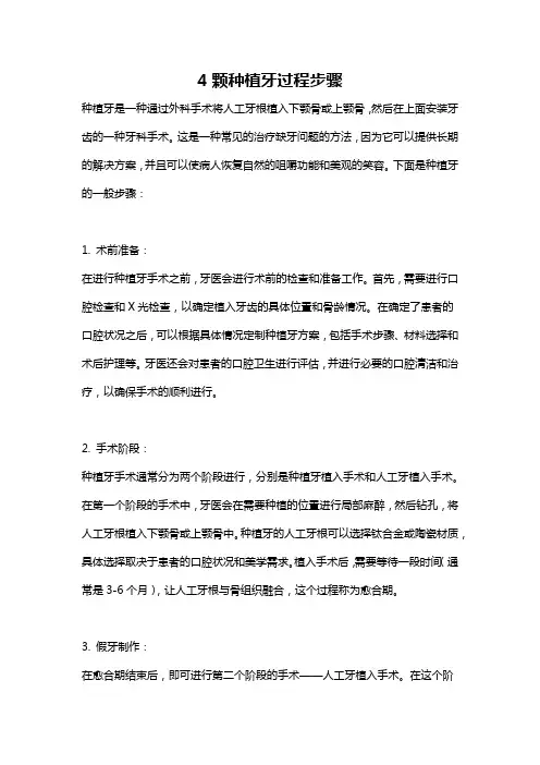 4颗种植牙过程步骤