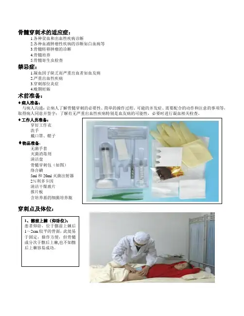 骨髓穿刺术指南