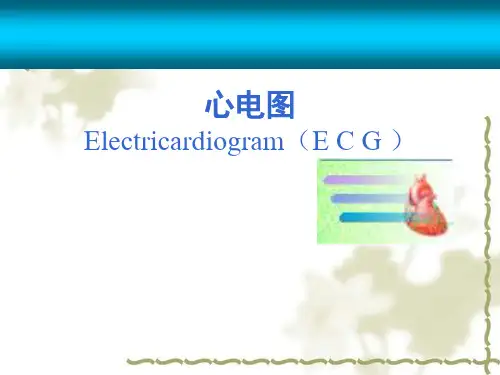 心电图详解