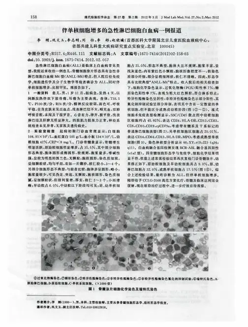 伴单核细胞增多的急性淋巴细胞白血病一例报道