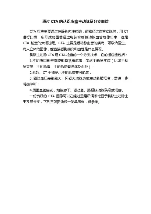 通过CTA的认识胸腹主动脉及分支血管