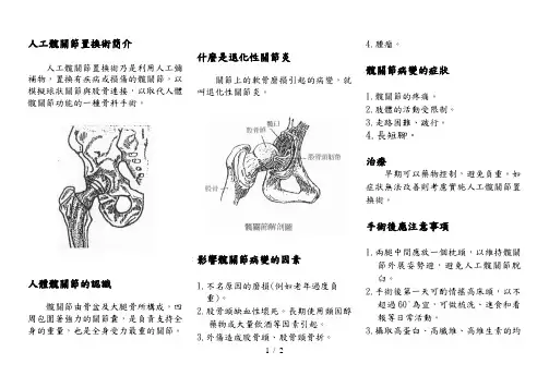 人工髋关节置换术简介概要