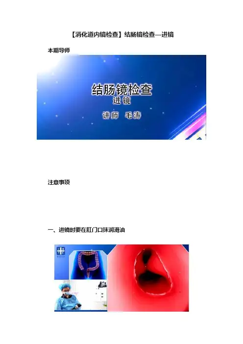 【消化道内镜检查】结肠镜检查—进镜