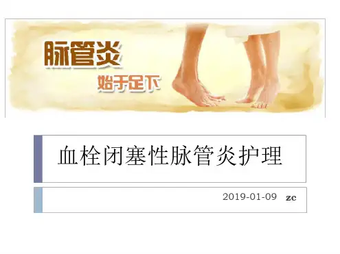 血栓闭塞性脉管炎_护理.ppt