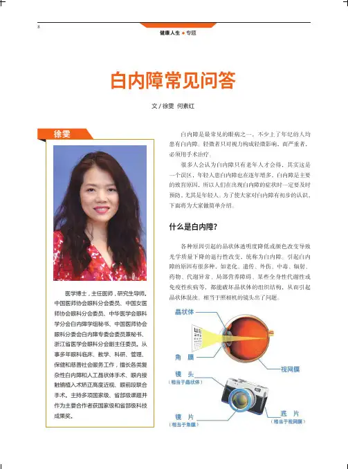 白内障常见问答