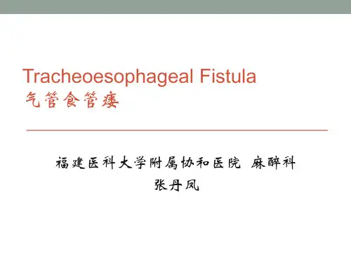 气管食管瘘--小儿麻醉病例