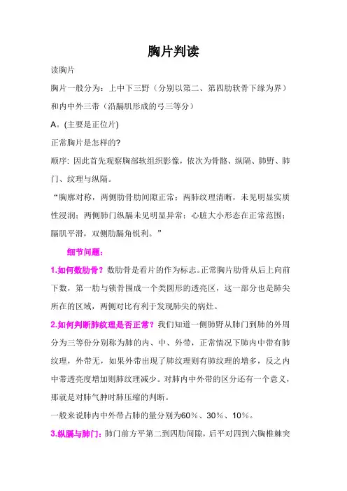 胸片判读