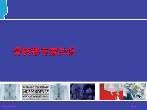 骨转移专家共识