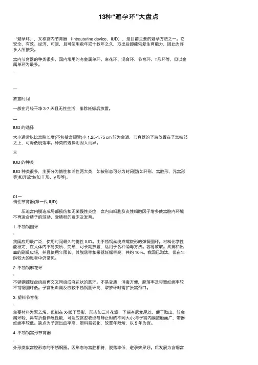 13种“避孕环”大盘点