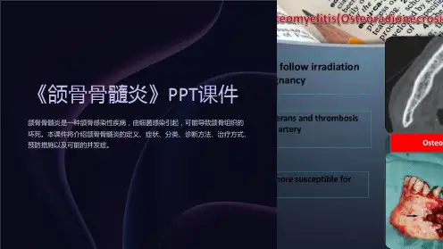 《颌骨骨髓炎》课件